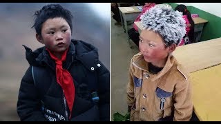 Boy Whose Hair Froze Walking To School Gets £245,000 In Donations