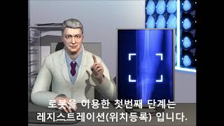 [큐렉소] 인공관절수술로봇 ROBODOC Process