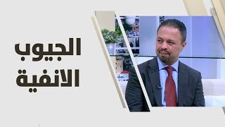 د. طارق خريس - الجيوب اﻻنفية - طب وصحة
