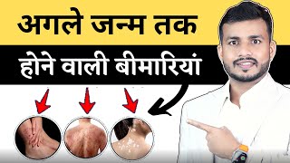 266:Skin Issues and Ayurved||
Kyu Tezi Se Fail Raha Hai Charm Rog