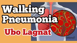 "WALKING PNEUMONIA" Delikado Ba? - Payo ni Doc Willie Ong #825