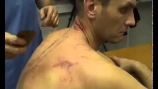 Гуаша массаж в Санкт-Петербурге. Диагностика организма массажем гуаша.
