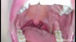 Swallowing / voring a bunch of helpless gummy bears