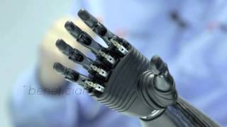 Nigel Ackland's BeBionic Robotic Arm (Amputee)