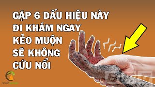 6 Dấu Hiệu Báo Trước Cơ Thể Bạn Lâm Bệnh, Đi Khám Ngay Đừng Chủ Quan Mà Hối Hận
