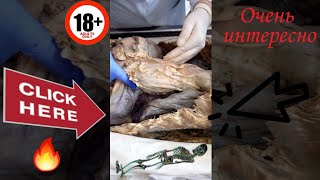 Легкие на трупе #анатомия #дыхательная #система  #БГМУ #BSMU