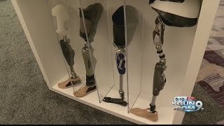 Amputee Conference: Hope and Strength on display