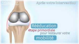 Bien vivre avec sa prothèse de genou | Arthrolink