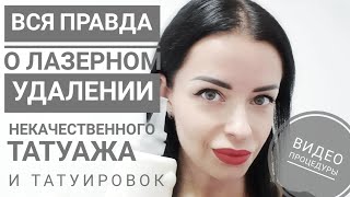 ?Лазерное удаление некачественного татуажа.?