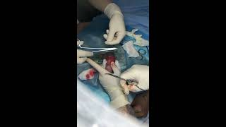 Cắt Bao Quy Đầu Tại Phòng Khám Đa Khoa Bảo Anh