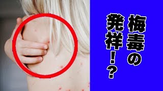 【都市伝説】梅毒の発祥！？
