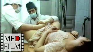 Разрыв шейки матки, влагалища, промежности © Rupture of the cervix, vagina, perineum