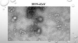 Wuhan China New Coronavirus 2019-nCoV Epidemic Soars and will Surpass SARS Soon