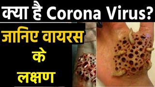 coronavirus kya hai || corona virus kya hai aur kaise hota hai