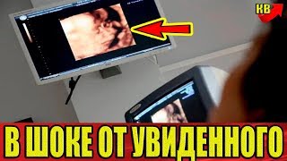 Беременная Девушка выложила фото УЗИ в сеть, все родственники и друзья были в шоке от увиденного.