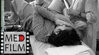 Токсикозы беременных, эклампсия © toxicoses of pregnant women