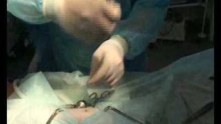 Лапароскопия. Кастрация кошки.  часть2 www.endovet.su