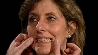 Cranial Nerve VII - Motor examination