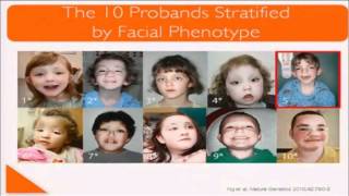 ASHG 2010 Mtg.: "Discovery of a Gene for Kabuki Syndrome by Exome Sequencing" (Mark Hannibal)