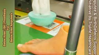 Artificial Limbs in Delhi : Best  Below Knee  Prosthesis India | Silicone Foot Delhi, Silicone Toe