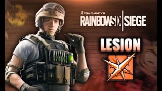 PERO MADRE MIA LESION | SOKI EN RAINBOW SIX SIEGE