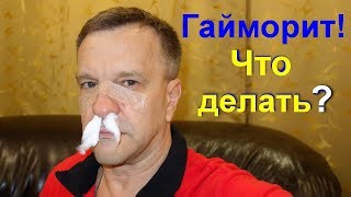 Лечение гайморита в домашних условиях. Гайморит как лечить народными средствами