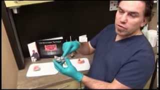 Types of Dental Implants