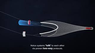 Activ Omni Intelligence Explained - The Notus Difference