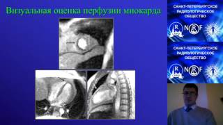 Лекция: «Магнитно-резонансная томография в диагностике ишемической болезни сердца»