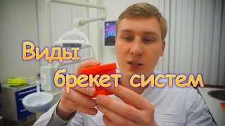 Виды брекет систем