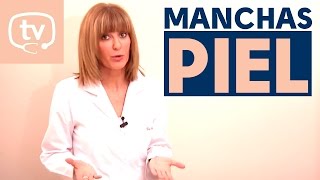 Algunos tipos de manchas en la piel y su tratamiento