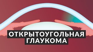 ?️ Открытоугольная глаукома ?️ 5 фактов об открытоугольной глаукоме! Все о зрении