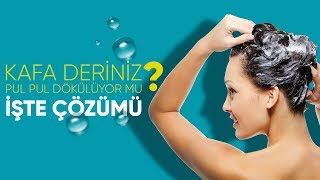 Kafa Deriniz Pul Pul Dökülüyor mu? -  Kerastase Bain Vital Dermo-Calm Yatıştırıcı Şampuan