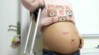 Amputee pregnant