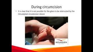 Medical Education: Infant Circumplast circumcision, UK