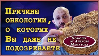 Что такое рак. Причины появления онкологии, о которых многие не знают