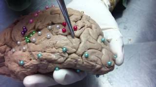 Monitoria de Neuroanatomia - Função dos Giros Cerebrais