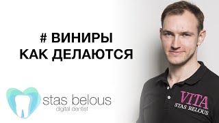 #Стоматолог Стас Белоус #Лечение #ВИНИРЫ Emax veneers with layering by Cerec