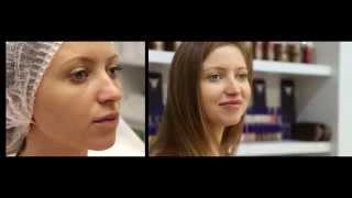 Коррекция формы губ с помощью гиалуроновой кислоты в салоне Naturel Studio