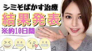 【IPL治療の結果！】そばかす、しみに悩んでいる方に参考にしてほしいです。