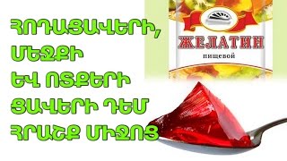 Ժողովրդական բժիշկ #19 Հոդացավերի, մեջքի և ոտքերի ցավերի դեմ հրաշք միջոց