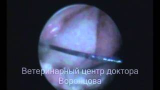 Буллезная болезнь легких