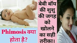 Baby boy के लिंग की चमड़ी कब तक ठीक से खुल जानी चाहिए|  लिंग में  हो इस तरह का बदलाव तो डॉ को दिखवाये