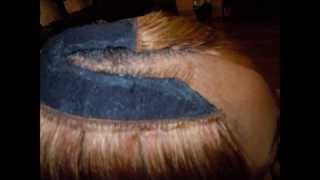 .** EXTREME OVERLAY** Illusion hairline and illusion part with a kokostar bob on traction alopecia