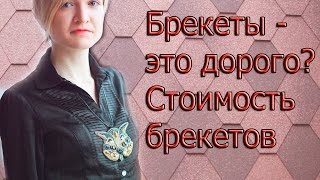 Сколько стоят брекеты. Брекеты это дорого?