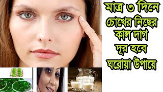 চোখের নিচে কালো দাগ দূর করার উপায় | মাত্র ৭ দিনে ত্বক ফর্সা করুন ।