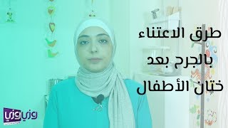 طرق الاعتناء بالجرح بعد ختان الأطفال