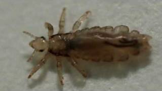 Is It Head Lice?
