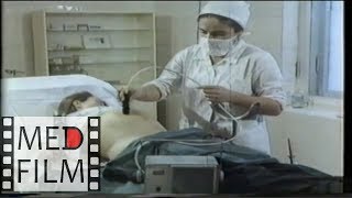 Роды при тазовом предлежании плода © Breech presentation of the fetus