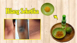 TAK PERLU PAKAI KRIM MAHAL!!! 1X GOSOK, KULIT HITAM BERDAKI DAN GATAL JADI PUTIH SELAMANYA
